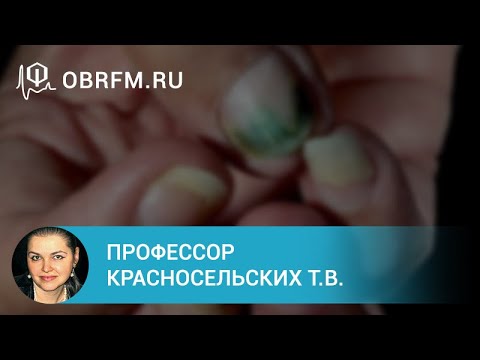 Видео: Профессор Красносельских Т.В.: Болезни ногтей