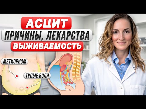 Видео: Асцит лечится? Причины, лекарства, выживаемость