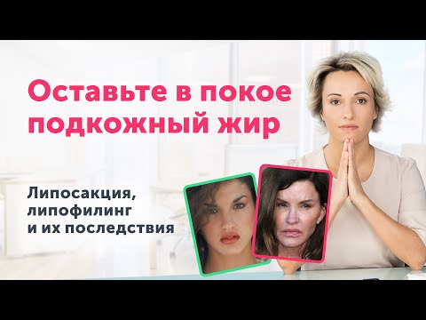 Видео: ОПАСНЫЕ манипуляции с подкожным ЖИРОМ: последствия липосакции и липофилинга