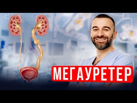 Видео: Мегауретер. Расширение мочеточника у детей. Что это, как выявить и когда оперировать?