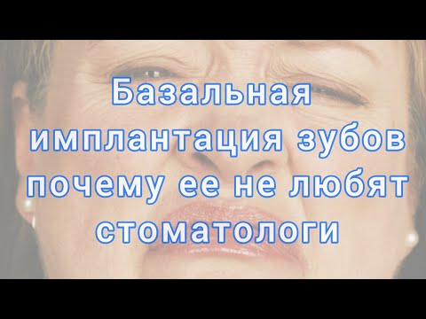 Видео: БАЗАЛЬНАЯ имплантация зубов.