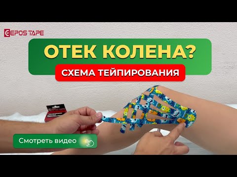 Видео: ✅Отеки коленного сустава.  Тейпирование колена.  Тейпы от отеков.