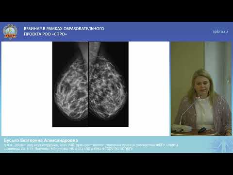 Видео: Вебинар "Ультразвуковое исследование в онкологической практике"