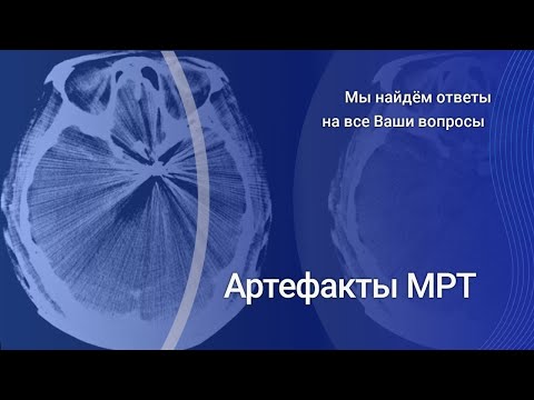 Видео: Артефакты МРТ