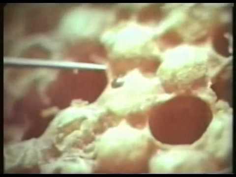 Видео: Варроатоз пчел. Способы Лечения Варроатоза