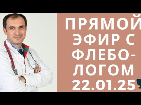 Видео: Флеболог Москва Максим Абасов в прямом эфире!