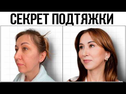 Видео: Подтяжка лица в 53 года - до и после пластической хирургии