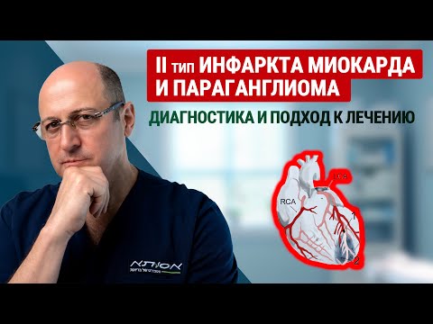 Видео: Второй тип инфаркта и параганглиома: диагностика и лечение | доктор Юрий Гольдес