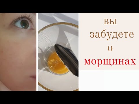 Видео: Всего 2 ингредиента и вы забудете о морщинах /лучшая маска от морщин
