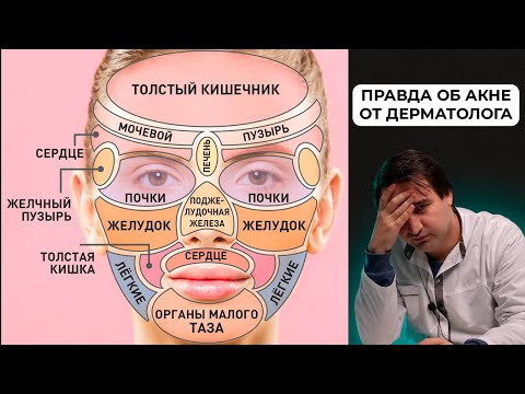 Видео: Правда об акне: мифы, в которые верят все!