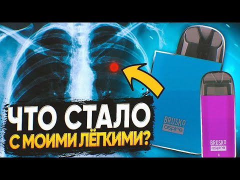 Видео: ЧТО СТАЛО С МОИМИ ЛЁГКИМИ ПОСЛЕ 5 ЛЕТ ПАРЕНИЯ ВЕЙПА?