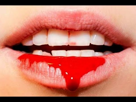 Видео: Выявление следов крови источником экспертного света