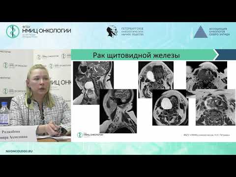 Видео: Возможности МРТ в диагностике распространенного рака щитовидной железы