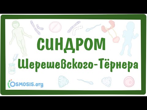 Видео: Синдром Шерешевского-Тёрнера — [моносомия X-хромосомы XО] — причины, симптомы, даигностика, лечение