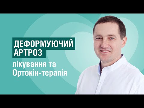 Видео: Остеоартроз: як діагностувати та лікувати | розповідає лікар ортопед-травматогог