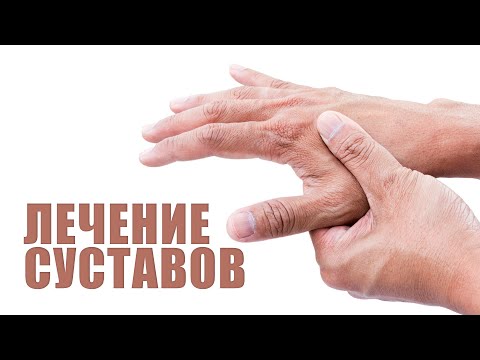 Видео: Лечение суставов кистей. Полиартрит, Артроз, артрит