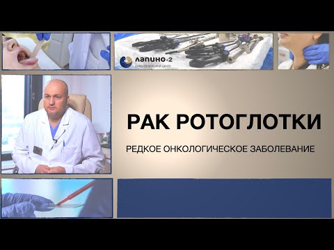 Видео: Рак ротоглотки: симптомы, диагностика, лечение.