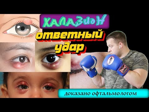 Видео: Халазион - Ответный удар