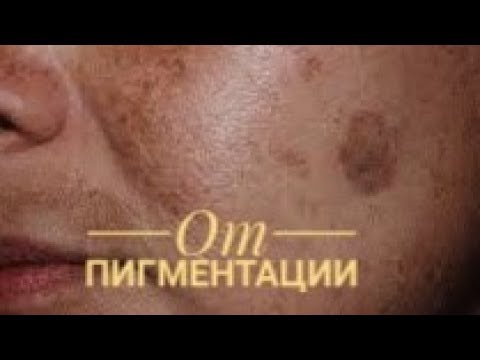 Видео: МОЩНОЕ средство ОТ ПИГМЕНТАЦИИ.  Быстро ОТБЕЛИТЬ КОЖУ.