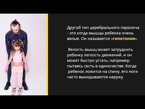 Видео: Гипотонус у ребенка