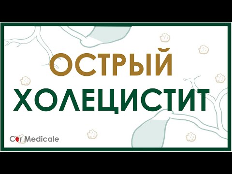 Видео: Острый холецистит - краткий обзор патогенеза