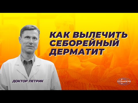 Видео: Как вылечить себорейный дерматит.