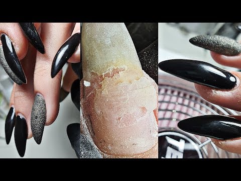 Видео: КРЮКИ на ногтях/спасаем ногти/работа другого мастера/кошка на ногтях