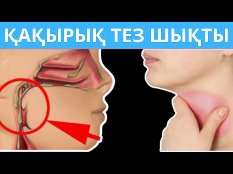 Видео: Қақырық түсіру үй жағдайында. Қақырық ТАМАҚТАН 1 КҮНДЕ ЗЫТЫП ШЫҚТЫ