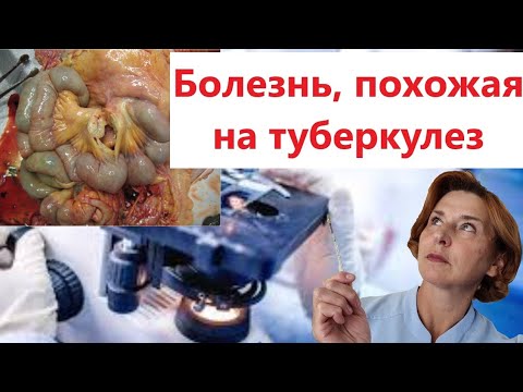Видео: Микобактериоз