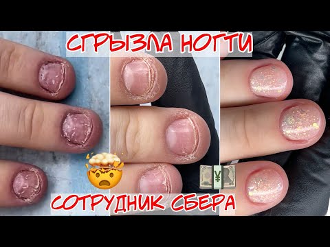 Видео: Как восстановить обкусанные ногти? / Грызуны