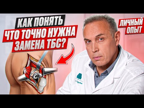 Видео: Не соглашайся НА ЭНДОПРОТЕЗИРОВАНИЕ до ЭТОГО ВОЗРАСТА – Когда соглашаться на замену сустава?