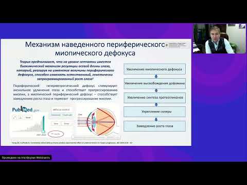 Видео: Алгоритм подбора мягких линз для контроля миопии при помощи диагностического набора