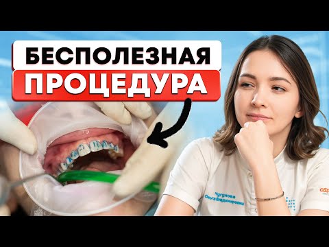 Видео: НЕ СОГЛАШАЙТЕСЬ НА ПРОФЕССИОНАЛЬНУЮ ГИГИЕНУ! Стоматологи молчат об этом