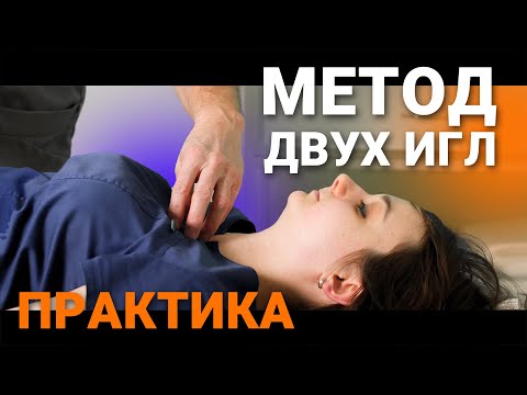 Видео: ПРАКТИКА МЕТОДА ДВУХ ИГЛ. Владимир Александров