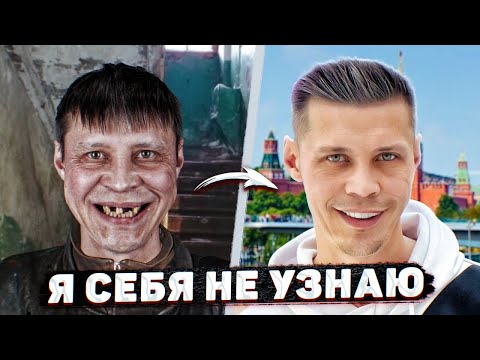 Видео: ДО СЛЁЗ! НОВЫЕ ЗУБЫ ДЛЯ БЕЗДОМНОГО САШИ! НЕВЕРОЯТНОЕ ПРЕОБРАЖЕНИЕ!