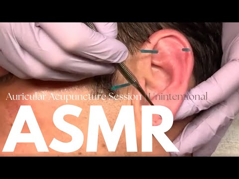 Видео: [ASMR] Лечение аурикулярной акупунктуры (ушной) | ASMR от реального человека 💜 при участии Тома