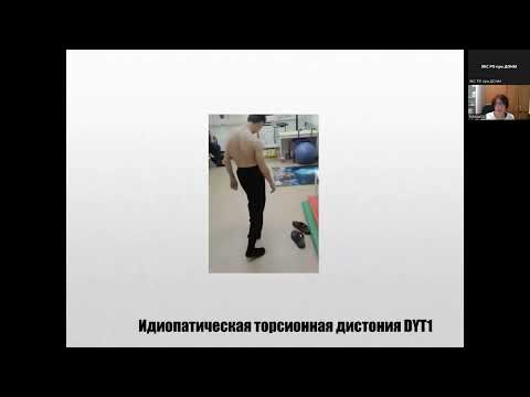 Видео: Нервные тики у детей: причины и профилактика