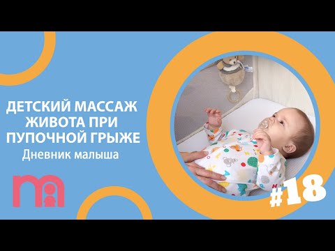 Видео: Детский массаж живота при пупочной грыже | Дневник малыша #18