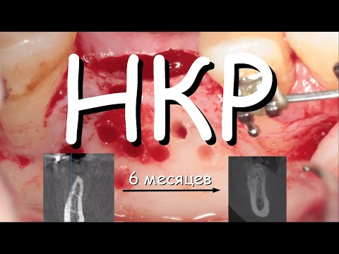 Видео: НКР. 46.