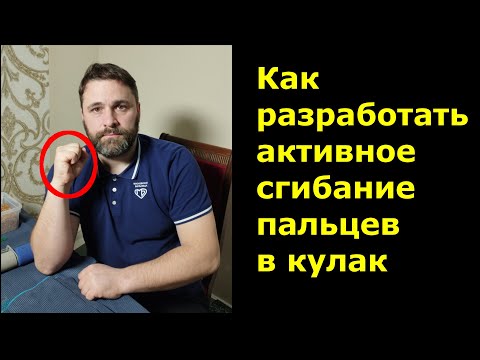 Видео: Как разработать активное сгибание пальцев в кулак