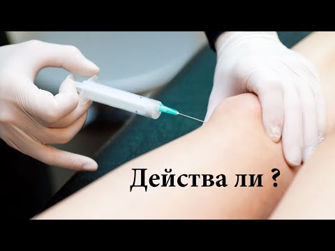 Видео: Инжекция с хиалуронова киселина при остеоартрит на коляното