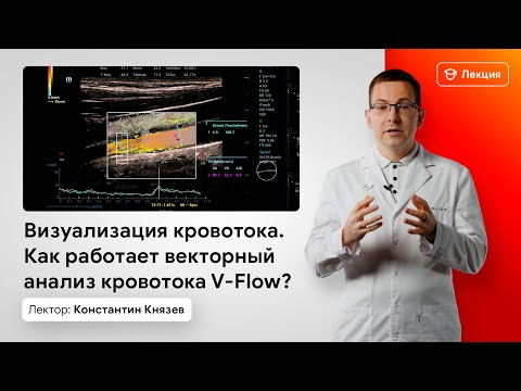 Видео: Визуализация кровотока. Как работает векторный анализ кровотока V-Flow?