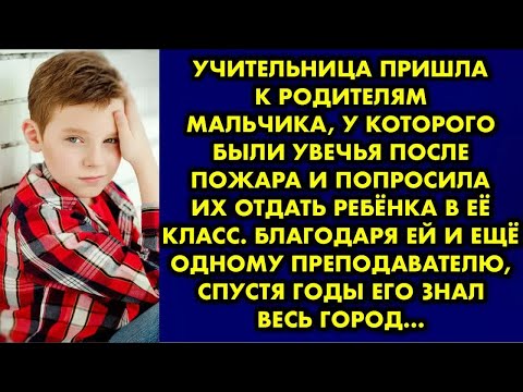 Видео: Учительница пришла к родителям мальчика, у которого были увечья после пожара и попросила их отдать