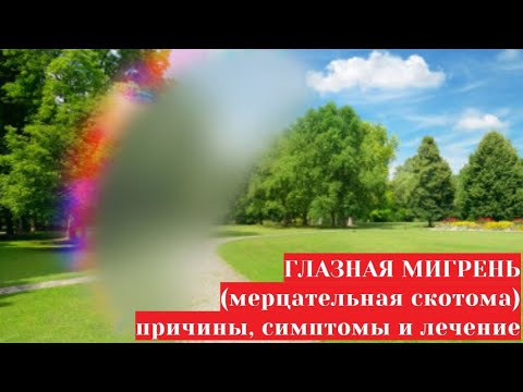 Видео: Глазная мигрень 💥👀🤕 (мерцательная аура) - причины, симптомы и лечение