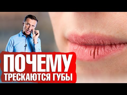 Видео: Почему трескаются губы? Сухие губы: что делать👄