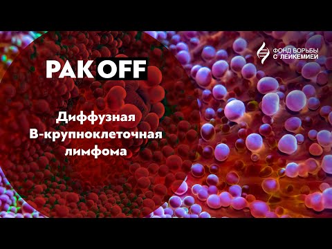 Видео: РакOFF: Диффузная В-крупноклеточная лимфома (ДВКЛ)