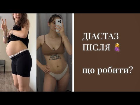 Видео: ТРЕНУВАННЯ ПРОТИ ДІАСТАЗУ | діастаз після вагітності