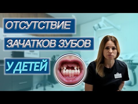 Видео: Детская Стоматология в  СОЧИ. Отсутствие зачатков зубов у детей. Студия Улыбок