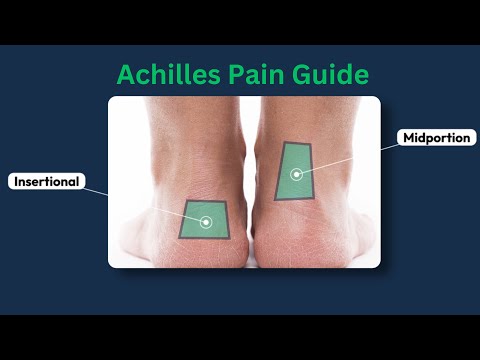 Видео: Тендинопатия ахиллова сухожилия / Тендинит / Упражнения / Лучшие методы лечения / Восстановление