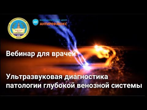 Видео: Вебинар для врачей Ультразвуковая диагностика патологии глубокой венозной системы